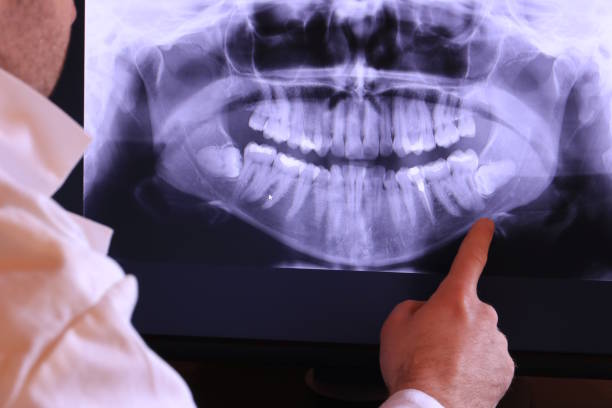 Best Emergency Denture Repair in Rushville, NE