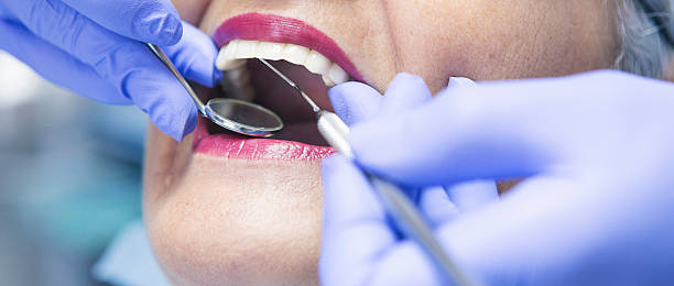Best Emergency Gum Treatment in Rushville, NE
